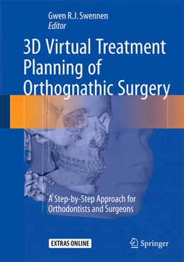 Abbildung von Swennen | 3D Virtual Treatment Planning of Orthognathic Surgery | 1. Auflage | 2016 | beck-shop.de