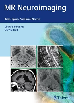 Abbildung von Jansen / Forsting | MR Neuroimaging | 1. Auflage | 2017 | beck-shop.de