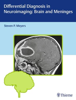 Abbildung von Meyers | Differential Diagnosis in Neuroimaging: Brain and Meninges | 1. Auflage | 2016 | beck-shop.de
