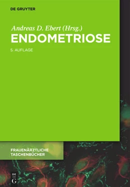 Abbildung von Ebert (Hrsg.) | Endometriose | 5. Auflage | 2018 | beck-shop.de