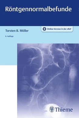 Abbildung von Möller | Röntgennormalbefunde | 6. Auflage | 2019 | beck-shop.de