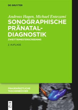 Abbildung von Entezami / Hagen | Sonographische Pränataldiagnostik | 1. Auflage | 2019 | beck-shop.de