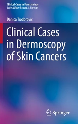 Abbildung von Tiodorovic | Clinical Cases in Dermoscopy of Skin Cancers | 1. Auflage | 2020 | beck-shop.de