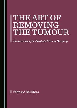 Abbildung von Moro | The Art of Removing the Tumour | 1. Auflage | 2020 | beck-shop.de