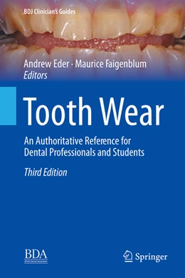 Abbildung von Eder / Faigenblum | Tooth Wear | 3. Auflage | 2022 | beck-shop.de