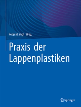 Abbildung von Vogt | Praxis der Lappenplastiken | 1. Auflage | 2026 | beck-shop.de