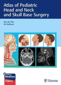 Abbildung von Fliss / Derowe | Atlas of Pediatric Head and Neck and Skull Base Surgery | 1. Auflage | 2020 | beck-shop.de