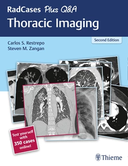 Abbildung von Restrepo / Zangan | RadCases Plus Q&A Thoracic Imaging | 2. Auflage | 2019 | beck-shop.de
