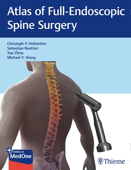 Abbildung von Hofstetter / Ruetten | Atlas of Full-Endoscopic Spine Surgery | 1. Auflage | 2020 | beck-shop.de