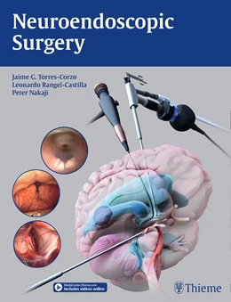Abbildung von Torres-Corzo / Rangel-Castilla | Neuroendoscopic Surgery | 1. Auflage | 2016 | beck-shop.de
