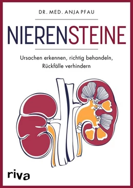 Abbildung von Pfau | Nierensteine - Ursachen erkennen, richtig behandeln, Rückfälle verhindern | 1. Auflage | 2023 | beck-shop.de