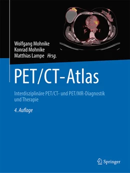 Abbildung von Mohnike / Lampe | PET/CT-Atlas | 4. Auflage | 2024 | beck-shop.de