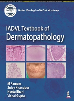 Abbildung von Ramam / Khandpur | IADVL Textbook of Dermatopathology | 1. Auflage | 2023 | beck-shop.de