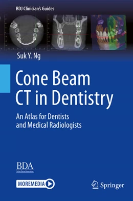 Abbildung von Ng | Cone Beam CT in Dentistry | 1. Auflage | 2024 | beck-shop.de
