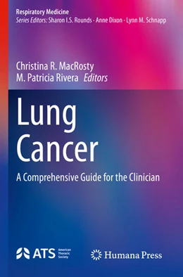 Abbildung von MacRosty / Rivera | Lung Cancer | 1. Auflage | 2024 | beck-shop.de
