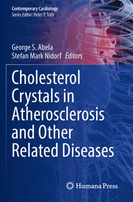 Abbildung von Abela / Nidorf | Cholesterol Crystals in Atherosclerosis and Other Related Diseases | 1. Auflage | 2024 | beck-shop.de