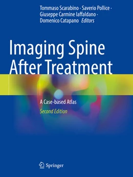 Abbildung von Scarabino / Pollice | Imaging Spine After Treatment | 2. Auflage | 2025 | beck-shop.de