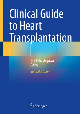 Abbildung von Kobashigawa | Clinical Guide to Heart Transplantation | 2. Auflage | 2025 | beck-shop.de