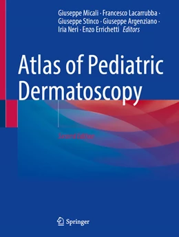 Abbildung von Micali / Lacarrubba | Atlas of Pediatric Dermatoscopy | 2. Auflage | 2025 | beck-shop.de