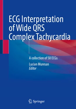 Abbildung von Muresan | ECG Interpretation of Wide QRS Complex Tachycardia  | 1. Auflage | 2025 | beck-shop.de