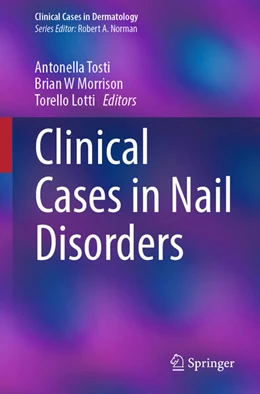 Abbildung von Tosti / Morrison | Clinical Cases in Nail Disorders | 1. Auflage | 2025 | beck-shop.de