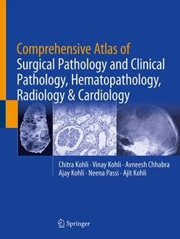 Abbildung von Kohli / Chhabra | Comprehensive Atlas of Surgical Pathology and Clinical Pathology, Hematopathology, Radiology & Cardiology | 1. Auflage | 2025 | beck-shop.de