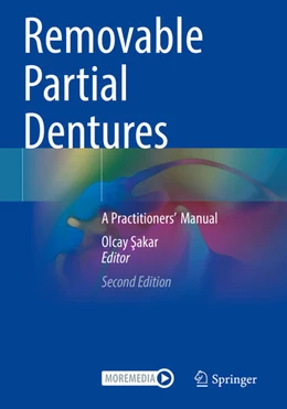 Abbildung von Sakar | Removable Partial Dentures | 2. Auflage | 2025 | beck-shop.de