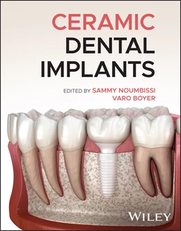 Abbildung von Noumbissi / Boyer | Ceramic Dental Implants | 1. Auflage | 2027 | beck-shop.de