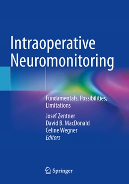 Abbildung von Zentner / MacDonald | Intraoperative Neuromonitoring | 1. Auflage | 2025 | beck-shop.de