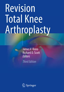 Abbildung von Bono / Scott | Revision Total Knee Arthroplasty | 3. Auflage | 2025 | beck-shop.de