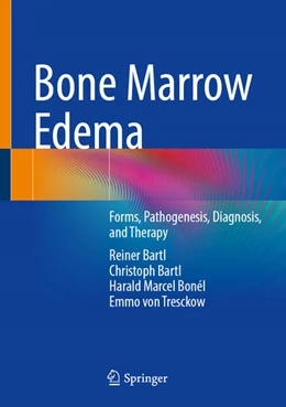 Abbildung von Bartl / Bonél | Bone Marrow Edema | 1. Auflage | 2025 | beck-shop.de