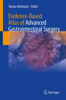 Abbildung von Heimann | Evidence-Based Atlas of Advanced Gastrointestinal Surgery | 1. Auflage | 2026 | beck-shop.de