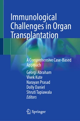 Abbildung von Abraham / Kute | Immunological Challenges in Organ Transplantation | 1. Auflage | 2025 | beck-shop.de