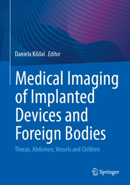 Abbildung von Kildal | Medical Imaging of Implanted Devices and Foreign Bodies | 1. Auflage | 2025 | beck-shop.de
