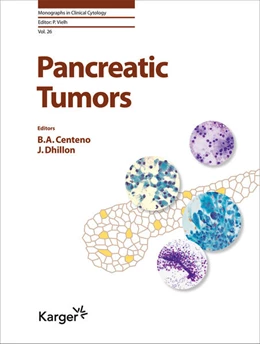 Abbildung von Centeno / Dhillon | Pancreatic Tumors | 1. Auflage | 2020 | beck-shop.de