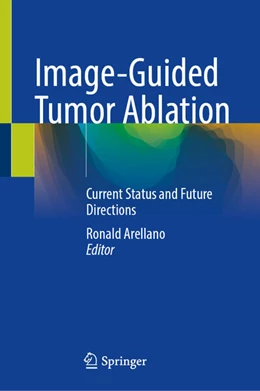 Abbildung von Arellano | Image-Guided Tumor Ablation | 1. Auflage | 2026 | beck-shop.de