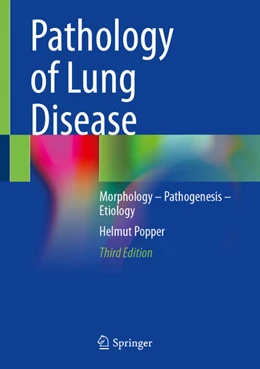 Abbildung von Popper | Pathology of Lung Disease | 3. Auflage | 2025 | beck-shop.de