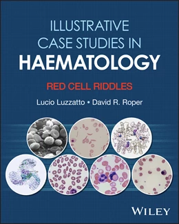 Abbildung von Luzzatto / Roper | Illustrative Case Studies in Haematology | 1. Auflage | 2026 | beck-shop.de