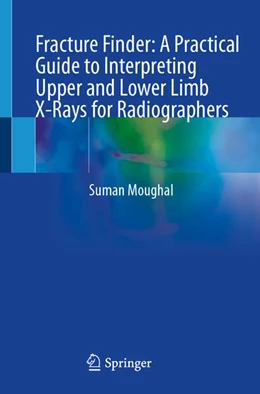 Abbildung von Moughal | Fracture Finder: A Practical Guide to Interpreting Upper and Lower Limb X-Rays for Radiographers | 1. Auflage | 2026 | beck-shop.de