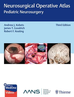 Abbildung von Kobets / Goodrich | Neurosurgical Operative Atlas: Pediatric Neurosurgery | 3. Auflage | 2026 | beck-shop.de