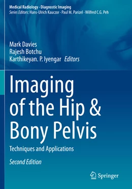 Abbildung von Davies / Botchu | Imaging of the Hip & Bony Pelvis | 2. Auflage | 2025 | beck-shop.de