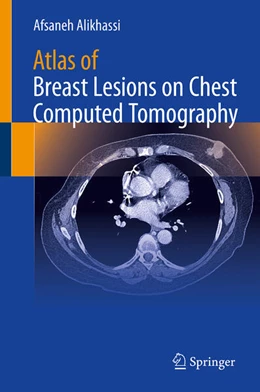 Abbildung von Alikhassi | Atlas of Breast Lesions on Chest Computed Tomography | 1. Auflage | 2026 | beck-shop.de