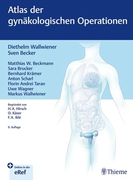Abbildung von Wallwiener / Becker | Atlas der gynäkologischen Operationen | 9. Auflage | 2026 | beck-shop.de