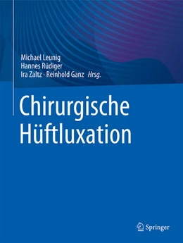Abbildung von Leunig / Rüdiger | Chirurgische Hüftluxation | 1. Auflage | 2026 | beck-shop.de