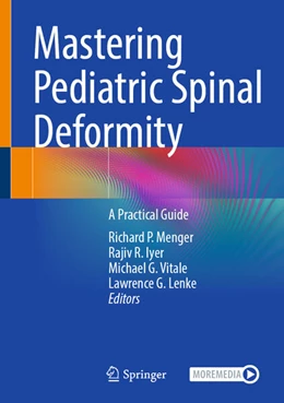 Abbildung von Menger / Iyer | Mastering Pediatric Spinal Deformity | 1. Auflage | 2026 | beck-shop.de