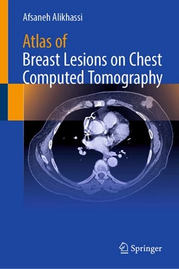 Abbildung von Alikhassi | Atlas of Breast Lesions on Chest Computed Tomography | 1. Auflage | 2026 | beck-shop.de