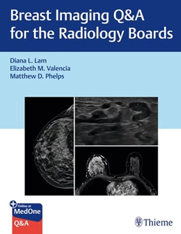 Abbildung von Lam / Valencia | Breast Imaging Q&A for the Radiology Boards | 1. Auflage | 2026 | beck-shop.de