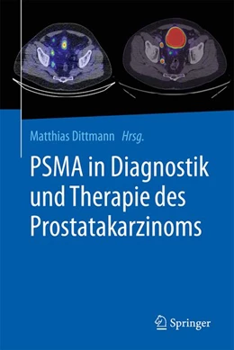 Abbildung von Dittmann | PSMA in Diagnostik und Therapie des Prostatakarzinoms | 1. Auflage | 2026 | beck-shop.de