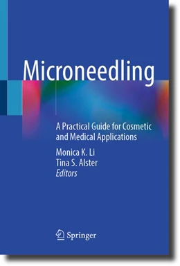 Abbildung von Li / Alster | Microneedling | 1. Auflage | 2026 | beck-shop.de