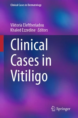 Abbildung von Ezzedine / Eleftheriadou | Clinical Cases in Vitiligo | 1. Auflage | 2026 | beck-shop.de